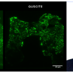 23/06 : Pierre Türschmann – High-throughput total internal reflection microscopy with QUSCITE